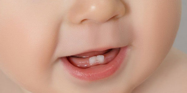 Здравјето на детските заби е важно